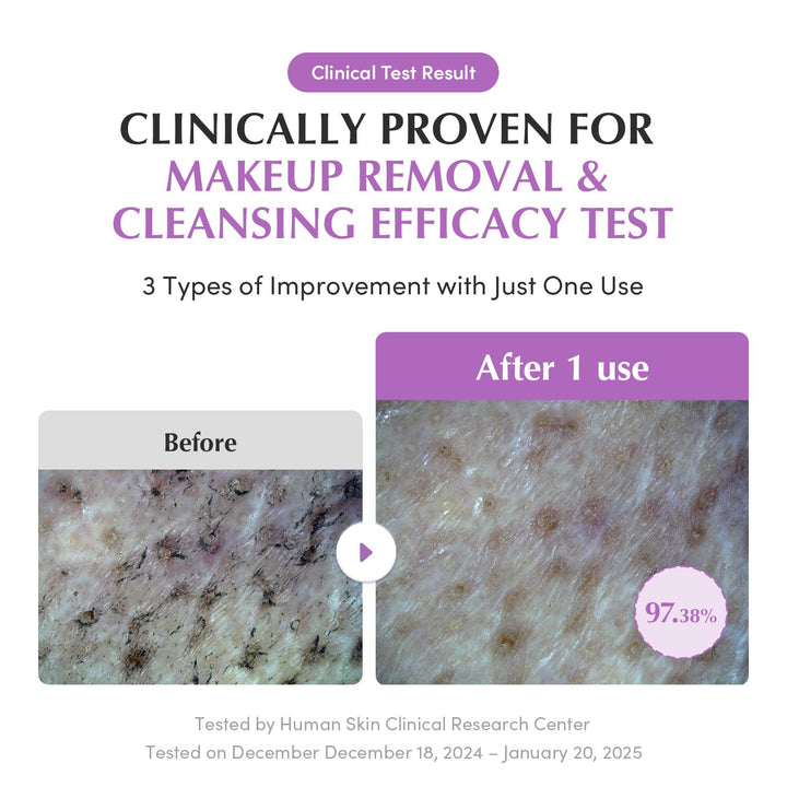 EQQUALBERRY Purple Rice Pore Smoothing Cleansing Oil, 6.76 fl oz