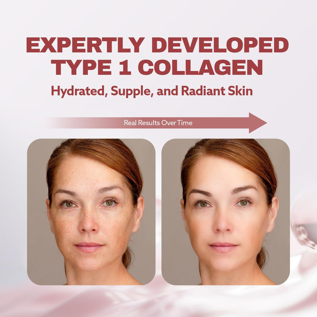 ILO Liquid Collagen Drink, Marine Type 1, 3000 mg, 14 Count