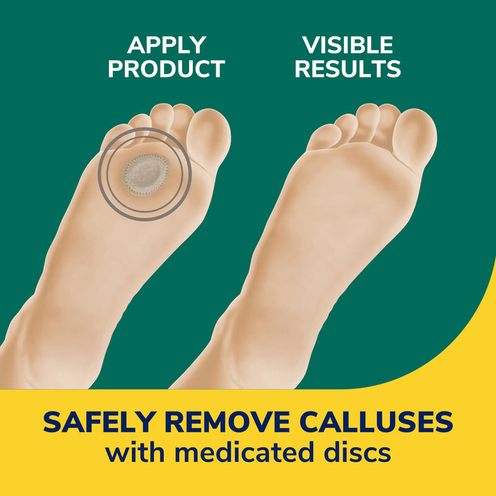 Dr. Scholl's Extra Thick Callus Remover, 4 Count