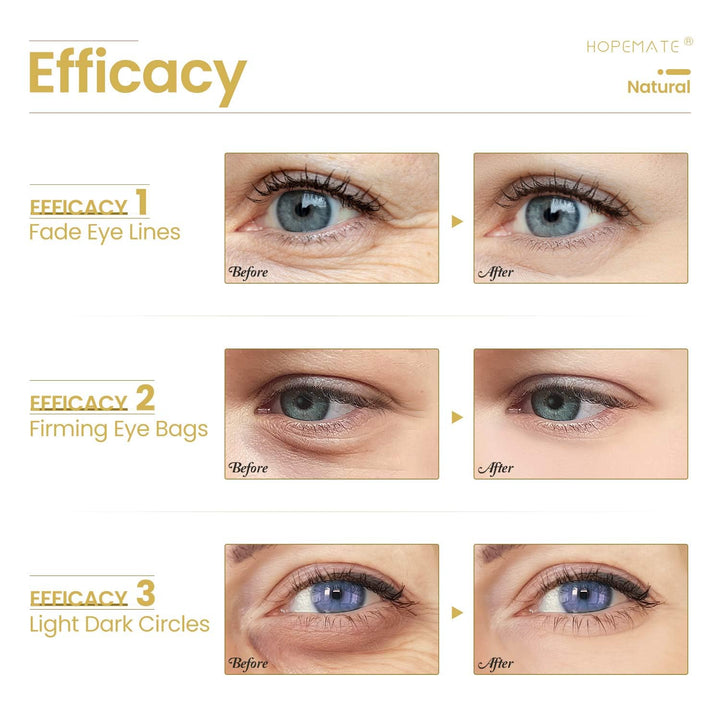 HOPEMATE Anti Age Eye Cream, Hyaluronic Acid, Natural and Organic