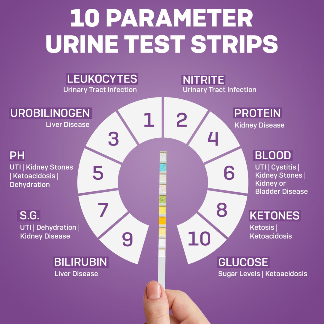 One Step Pet Urine Testing Strips, 50 Count