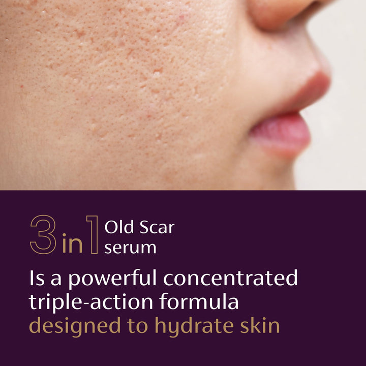 Mederma Scar Serum, 1 fl oz