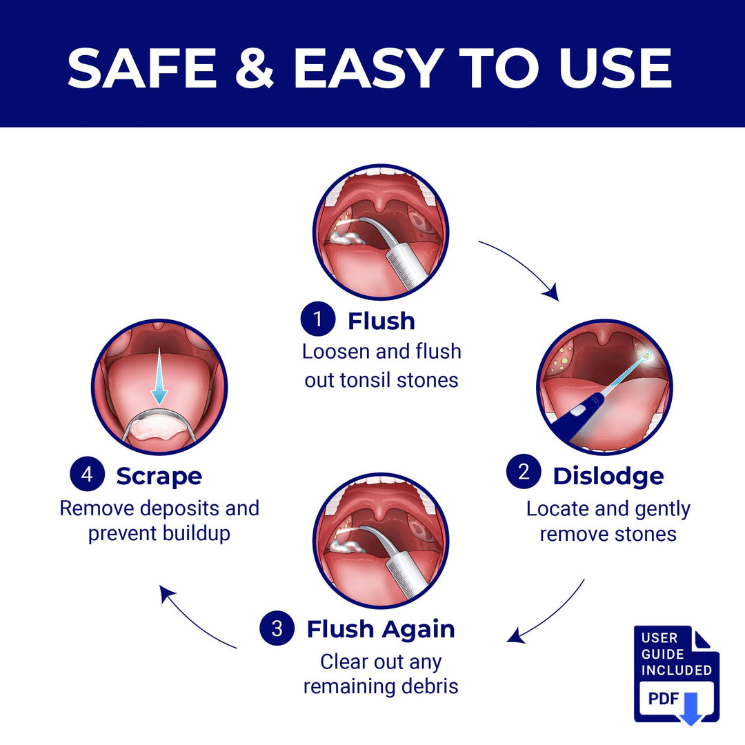 ORAVIX Tonsil Stone Remover Kit, 7 Count