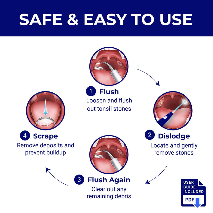 ORAVIX Tonsil Stone Remover Kit, 7 Count