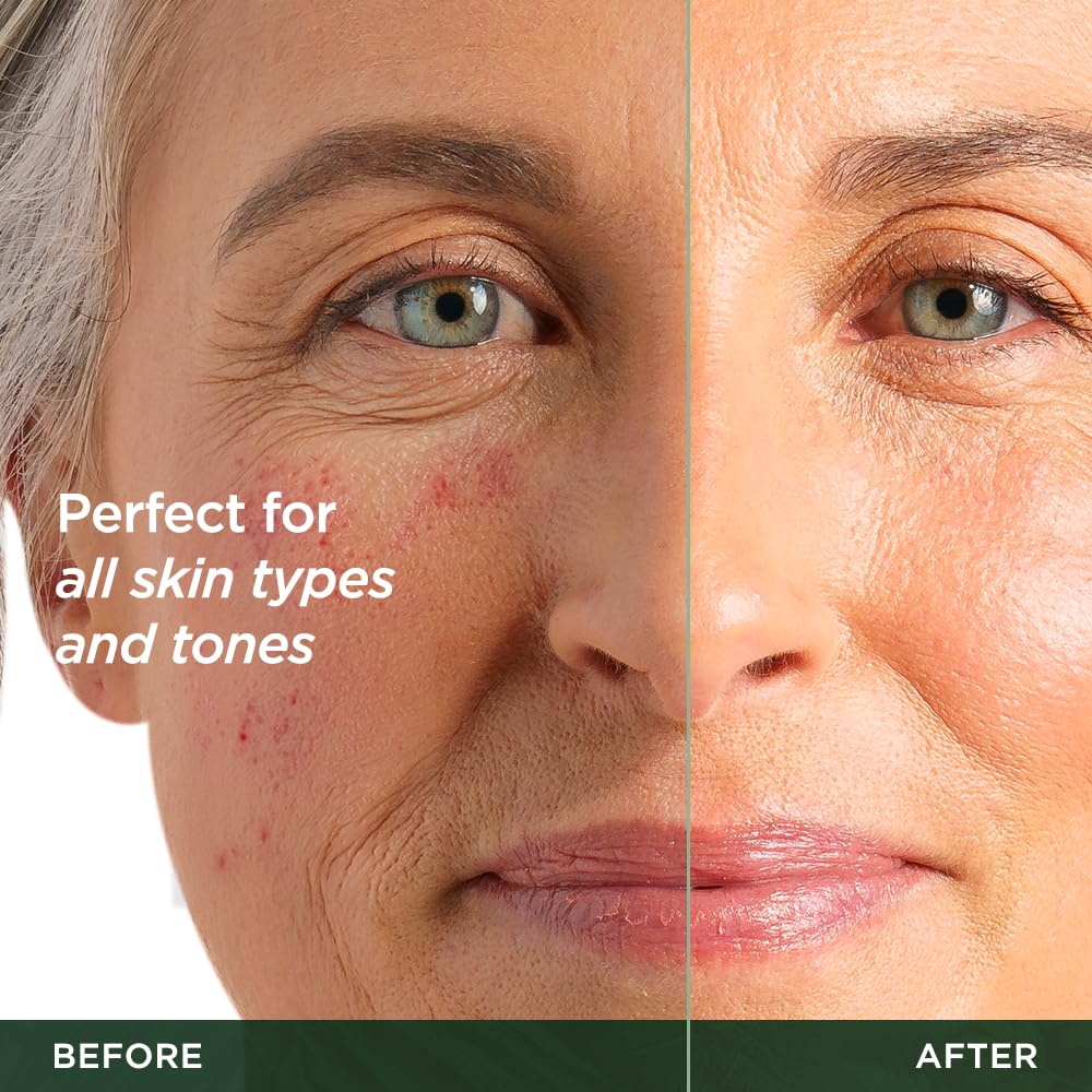 Flawless. Younger. Perfect. Vitamin C Serum Moisturizer