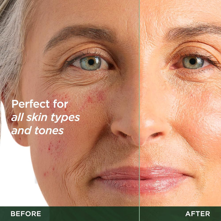 Flawless. Younger. Perfect. Vitamin C Serum Moisturizer