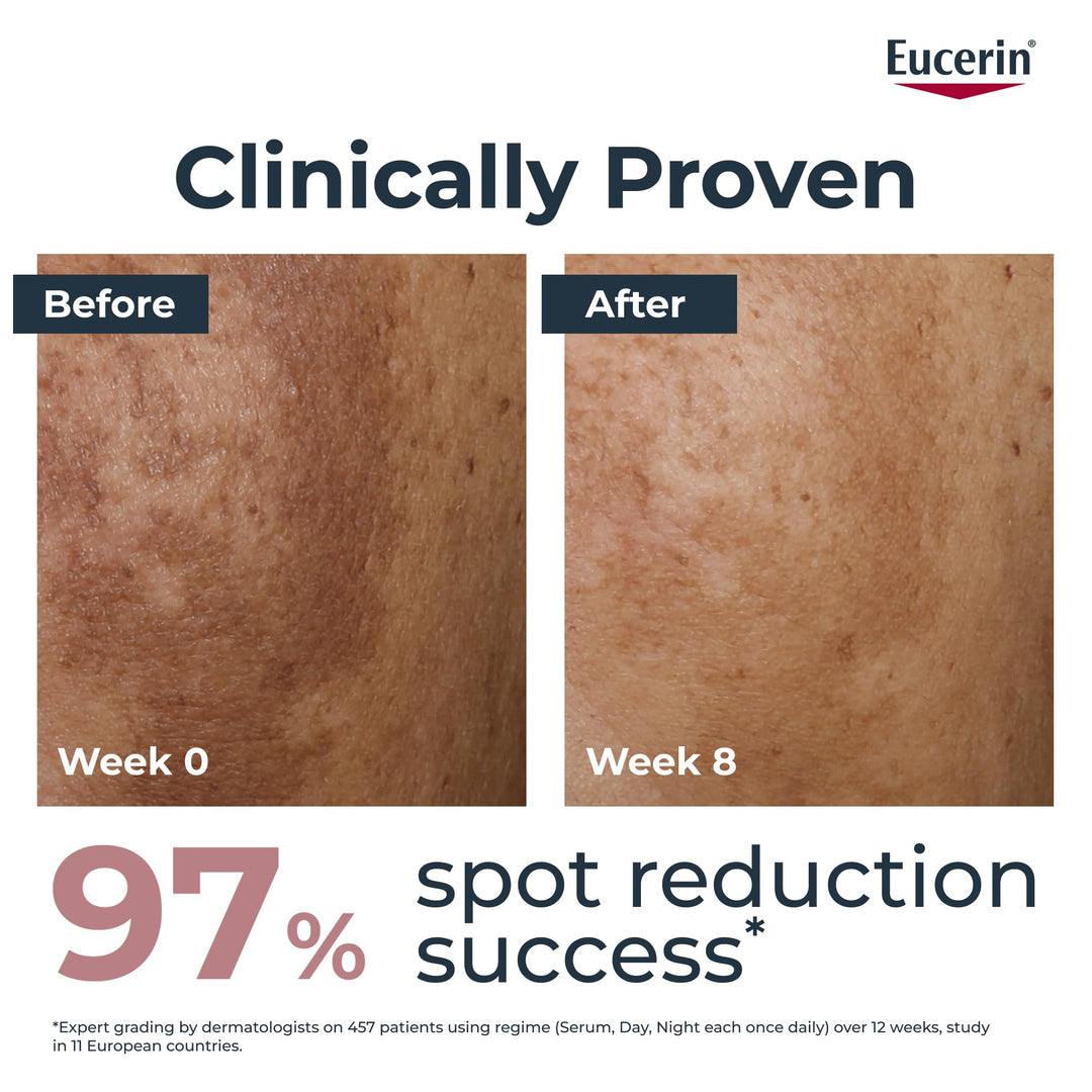 Eucerin Anti-Pigment Night Cream, 50 ml
