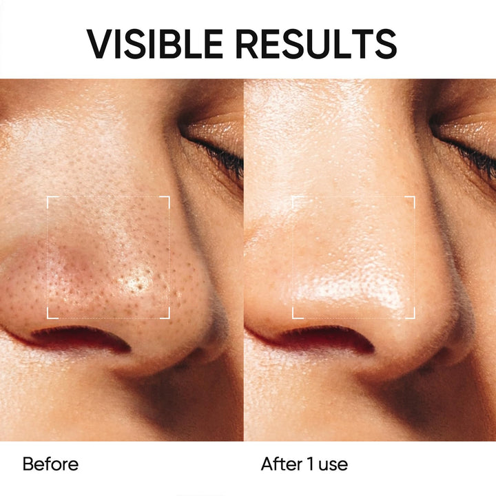 SKINTIFIC Blackhead Remover Face Mask Stick