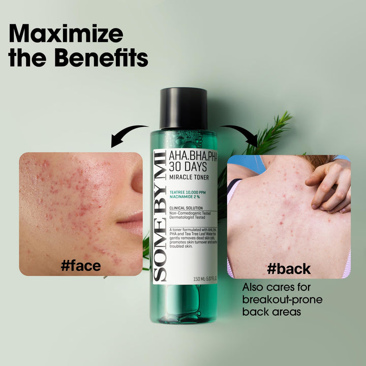 Some by MI AHA BHA PHA 30 Days Miracle Toner, 150 ml