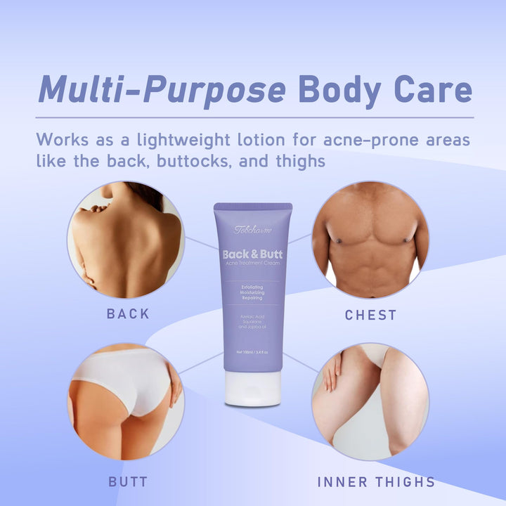 Tobcharm Butt Acne Clearing Treatment, Maximum Strength