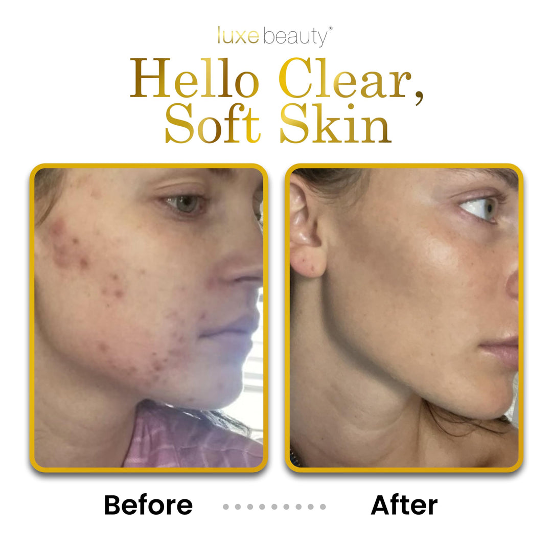 LUXEBEAUTY Luxe Lotion Hyaluronic Acid Moisturizer
