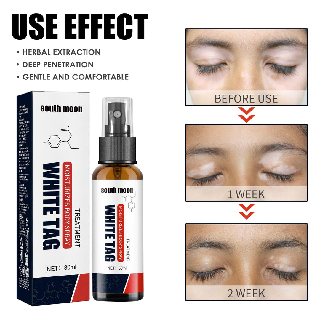 Ellisalano Natural White Spot Treatment Spray, 1 Count