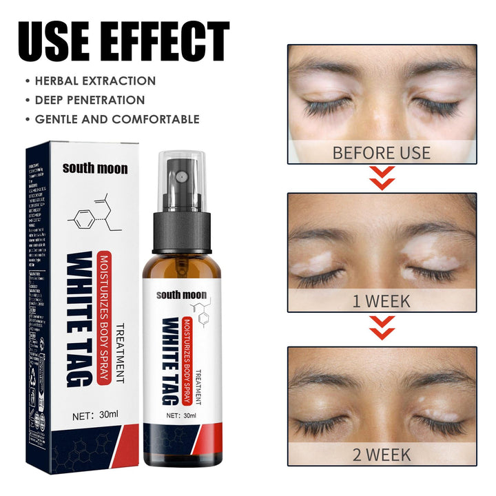Ellisalano Natural White Spot Treatment Spray, 1 Count