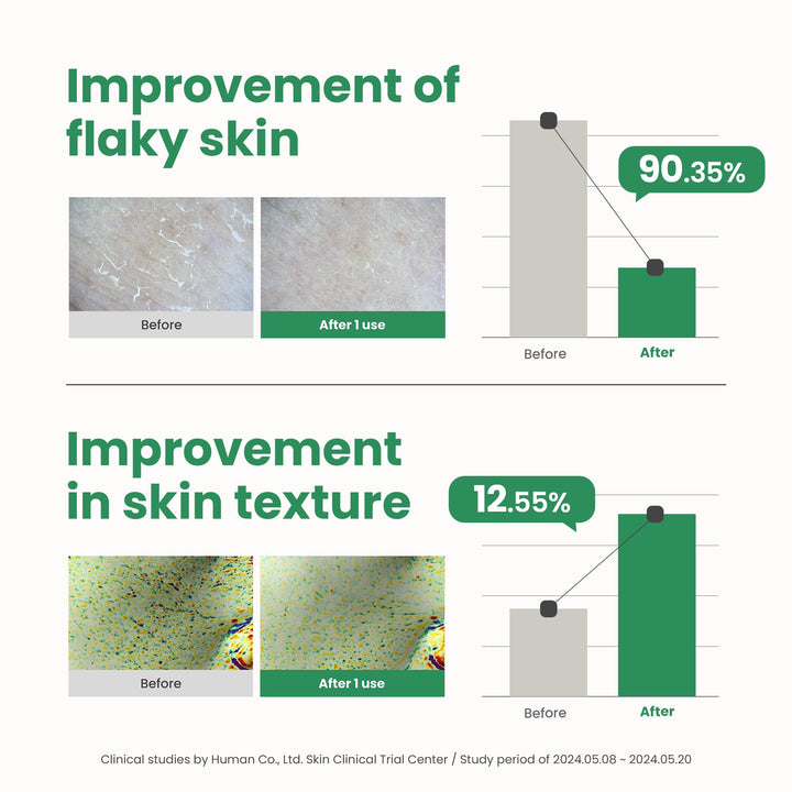 AXIS-Y PHA Resurfacing Glow Peel, 1.69 fl oz