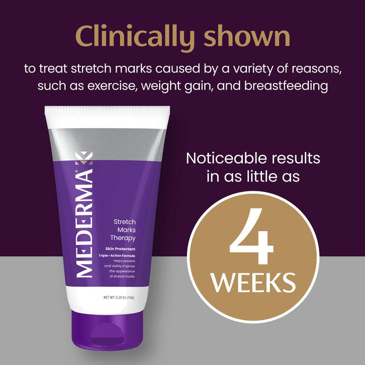 Mederma Stretch Marks Therapy, Ivory, 150 g