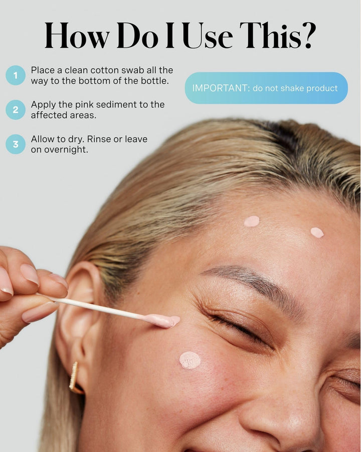 Kate Somerville EradiKate Acne Treatment, 10% Sulfur, 1 fl oz