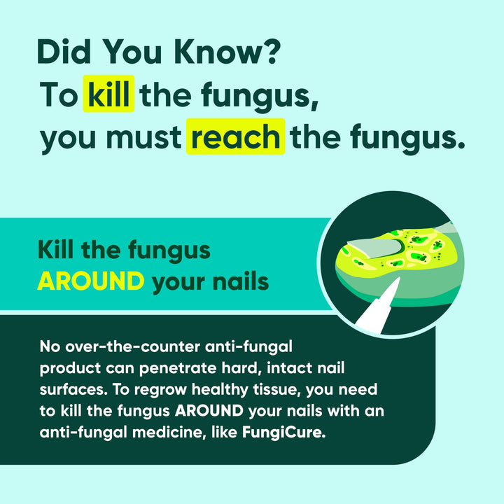FUNGICURE Anti-Fungal Liquid Gel, 0.35 oz