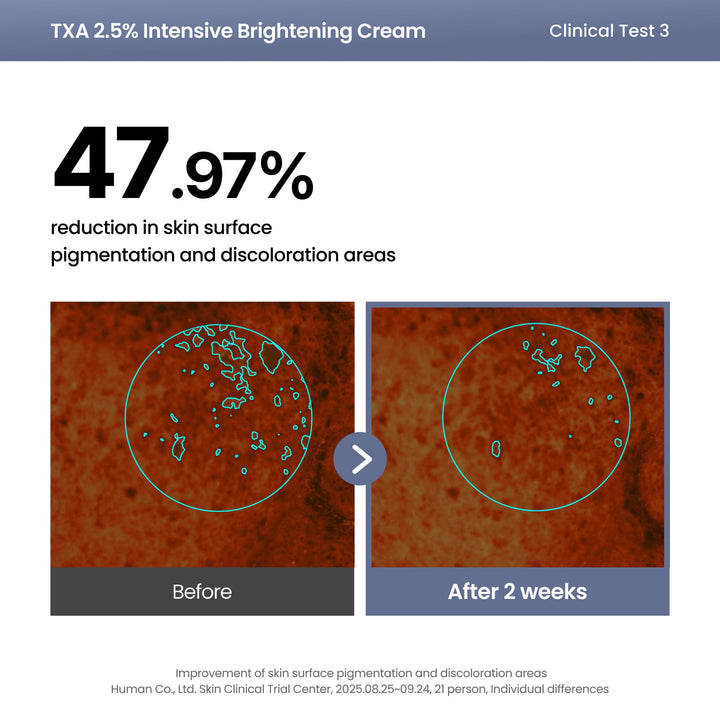 AXIS-Y TXA 2.5% Intensive Brightening Cream, 1.69 fl oz