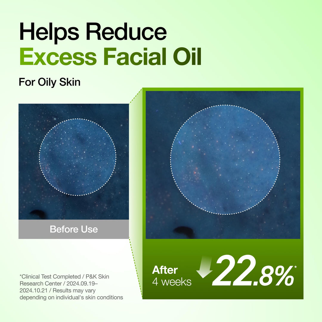 ANUA Azelaic Acid 10 Hyaluron Redness Soothing Serum, 1.01 fl oz