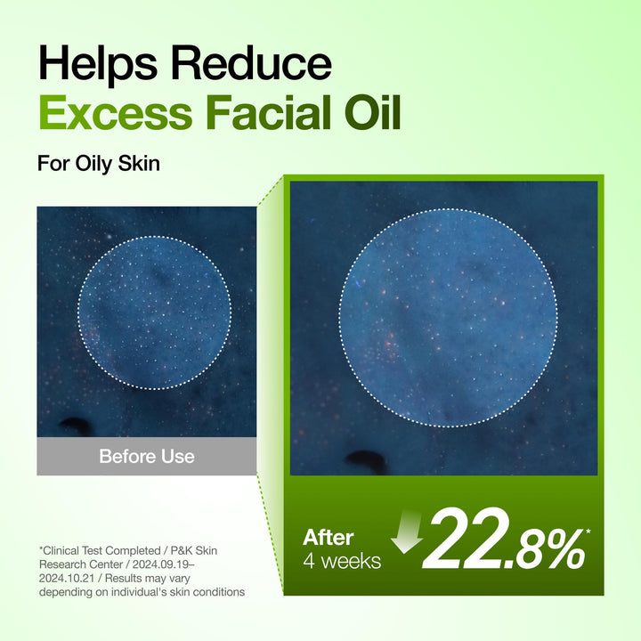 ANUA Azelaic Acid 10 Hyaluron Redness Soothing Serum, 1.01 fl oz
