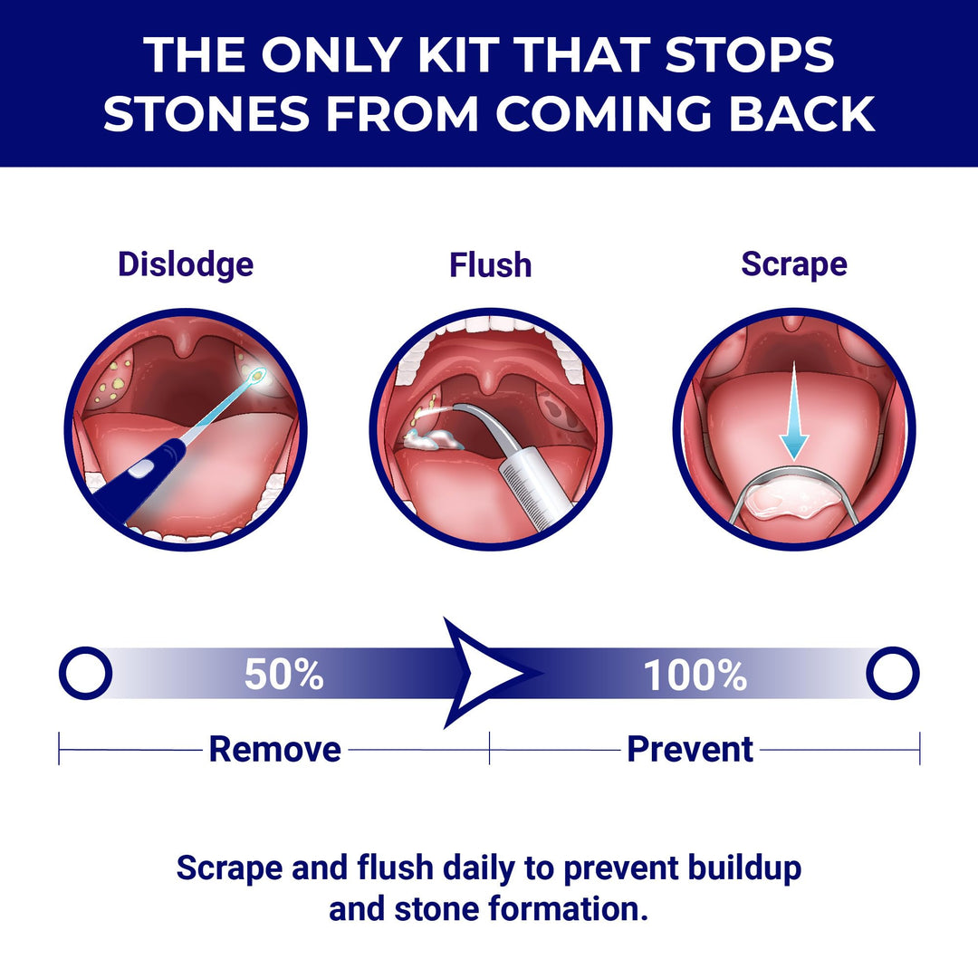 ORAVIX Tonsil Stone Remover Kit, 7 Count