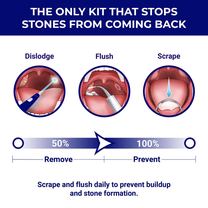 ORAVIX Tonsil Stone Remover Kit, 7 Count