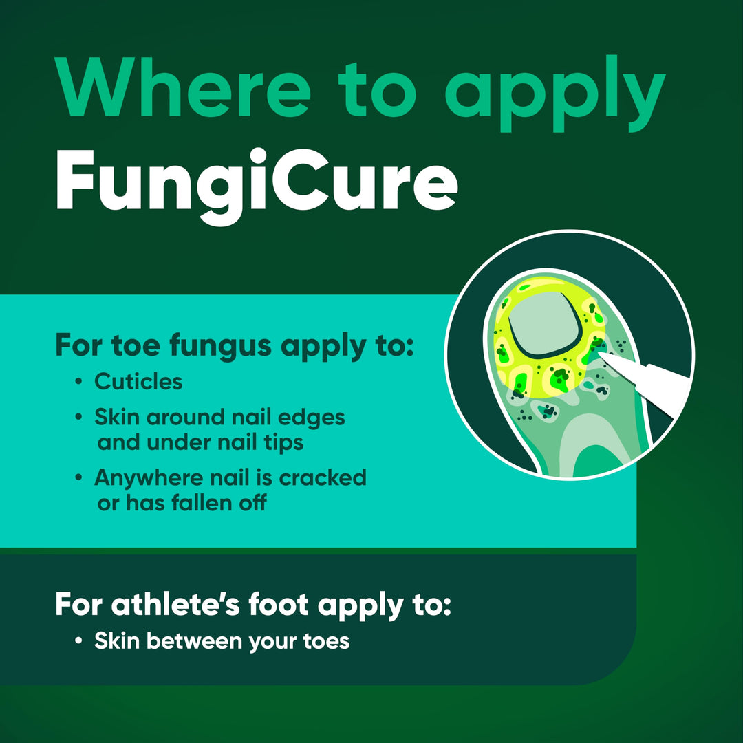 FUNGICURE Anti-Fungal Liquid Gel, 0.35 oz