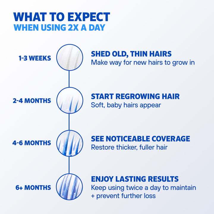 Rogaine Hair Regrowth Treatment, Topical Solution, 60 ml