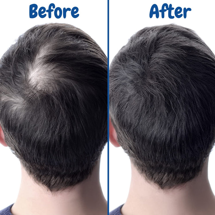 Verseo Hair Growth Conditioner