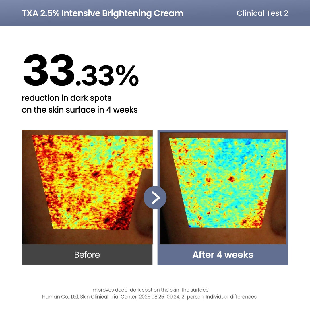 AXIS-Y TXA 2.5% Intensive Brightening Cream, 1.69 fl oz