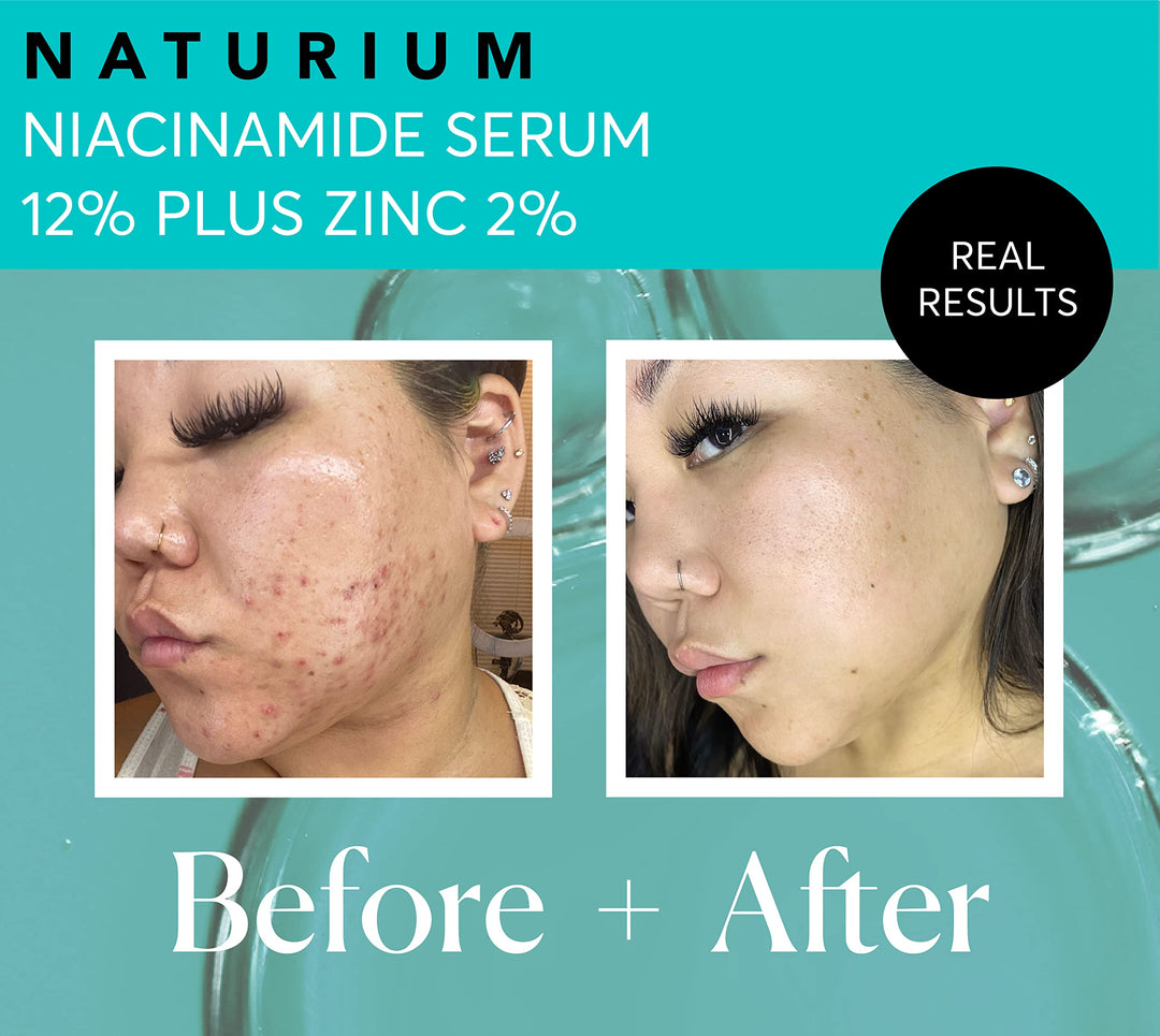 Naturium Niacinamide Face Serum 12% Plus Zinc 2%, 2 oz