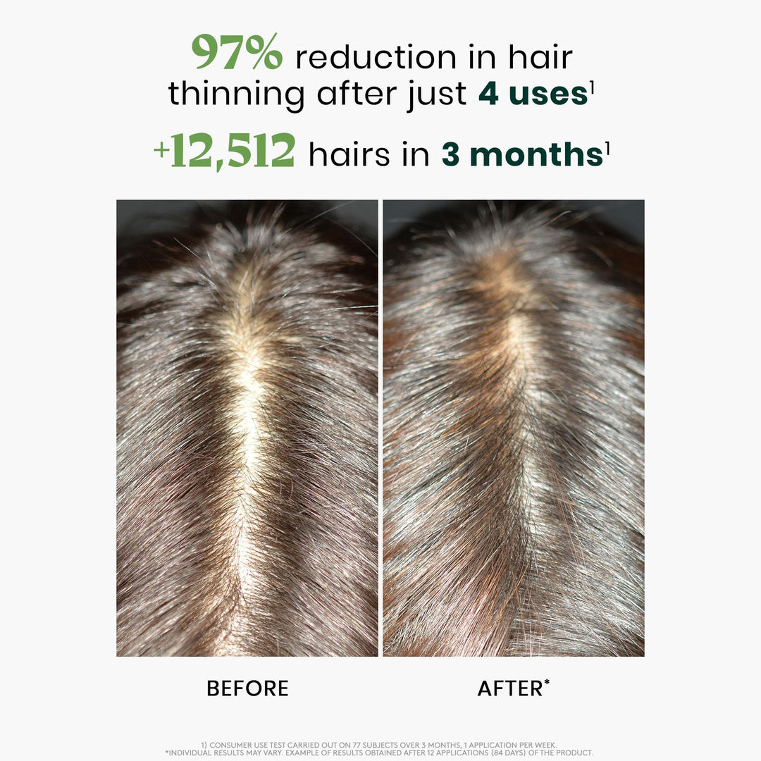 René Furterer Triphasic Reactional Hair Thickening Serum, 12 Count
