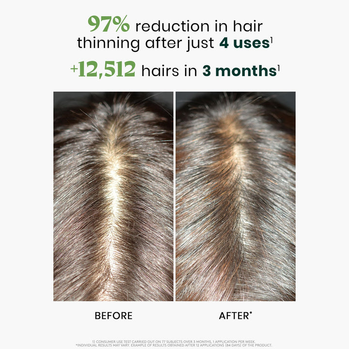 René Furterer Triphasic Reactional Hair Thickening Serum, 12 Count