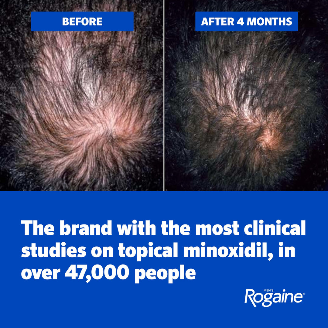 Rogaine Men's 5% Minoxidil Foam, 3 Month Supply