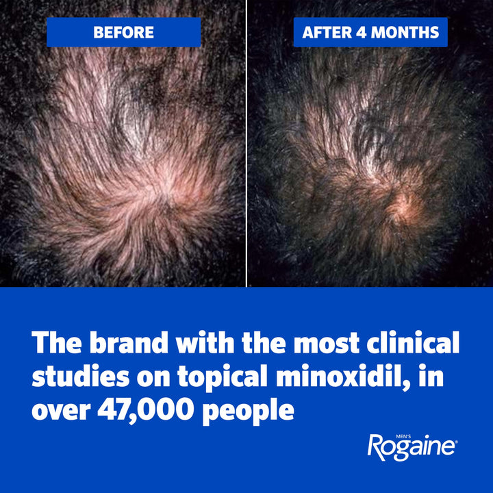 Rogaine Men's 5% Minoxidil Foam, 3 Month Supply