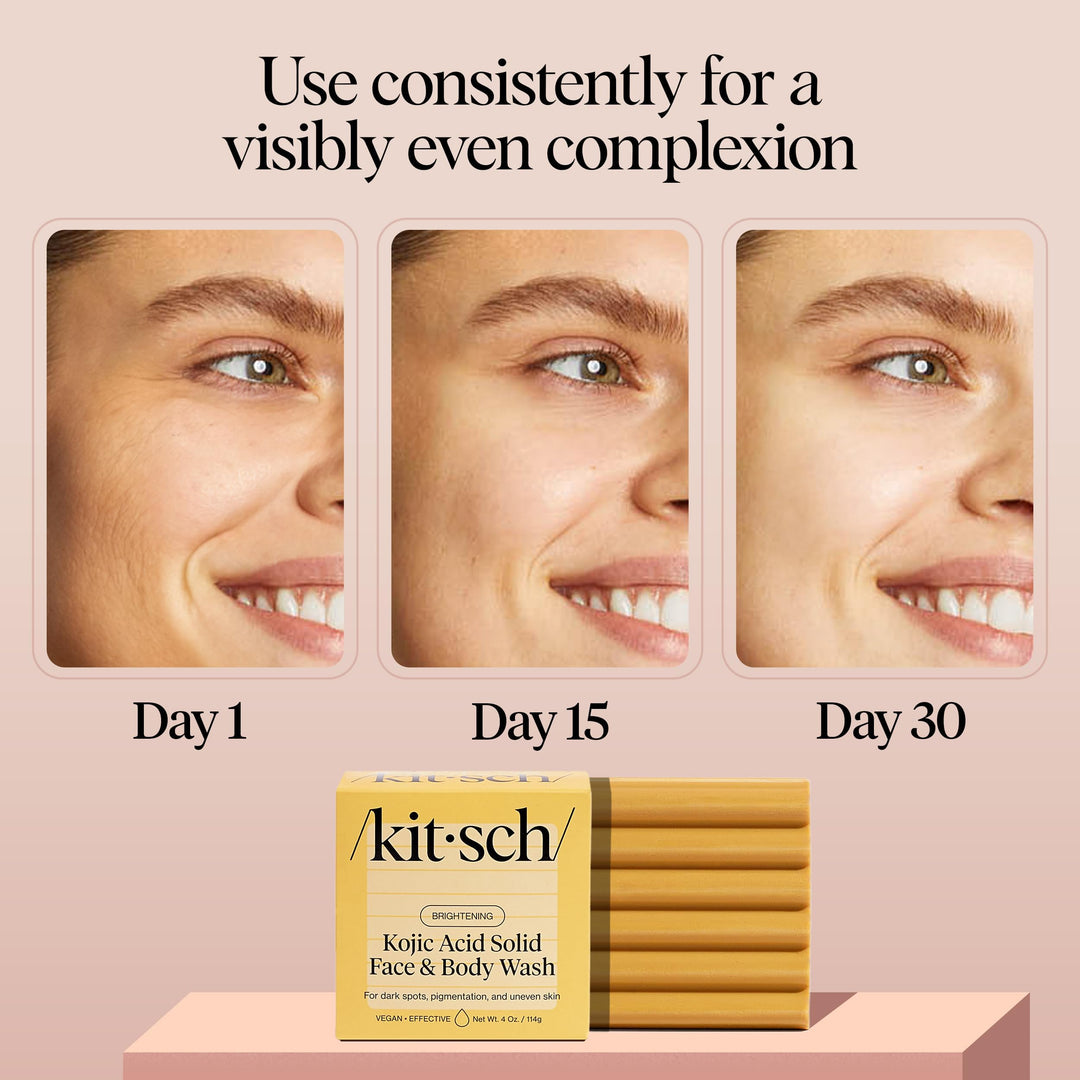 Kitsch Kojic Acid Soap Bar with Turmeric, 4 oz