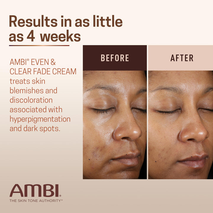 Ambi Even & Clear Fade Cream, 1 fl oz