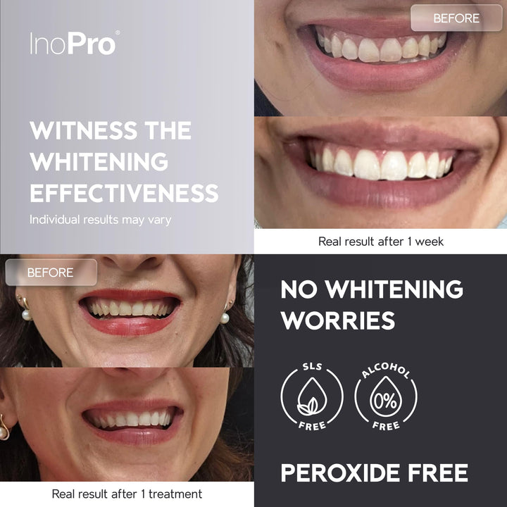 INOPRO / Natural Teeth Whitening Strips Kit, 14 Treatments
