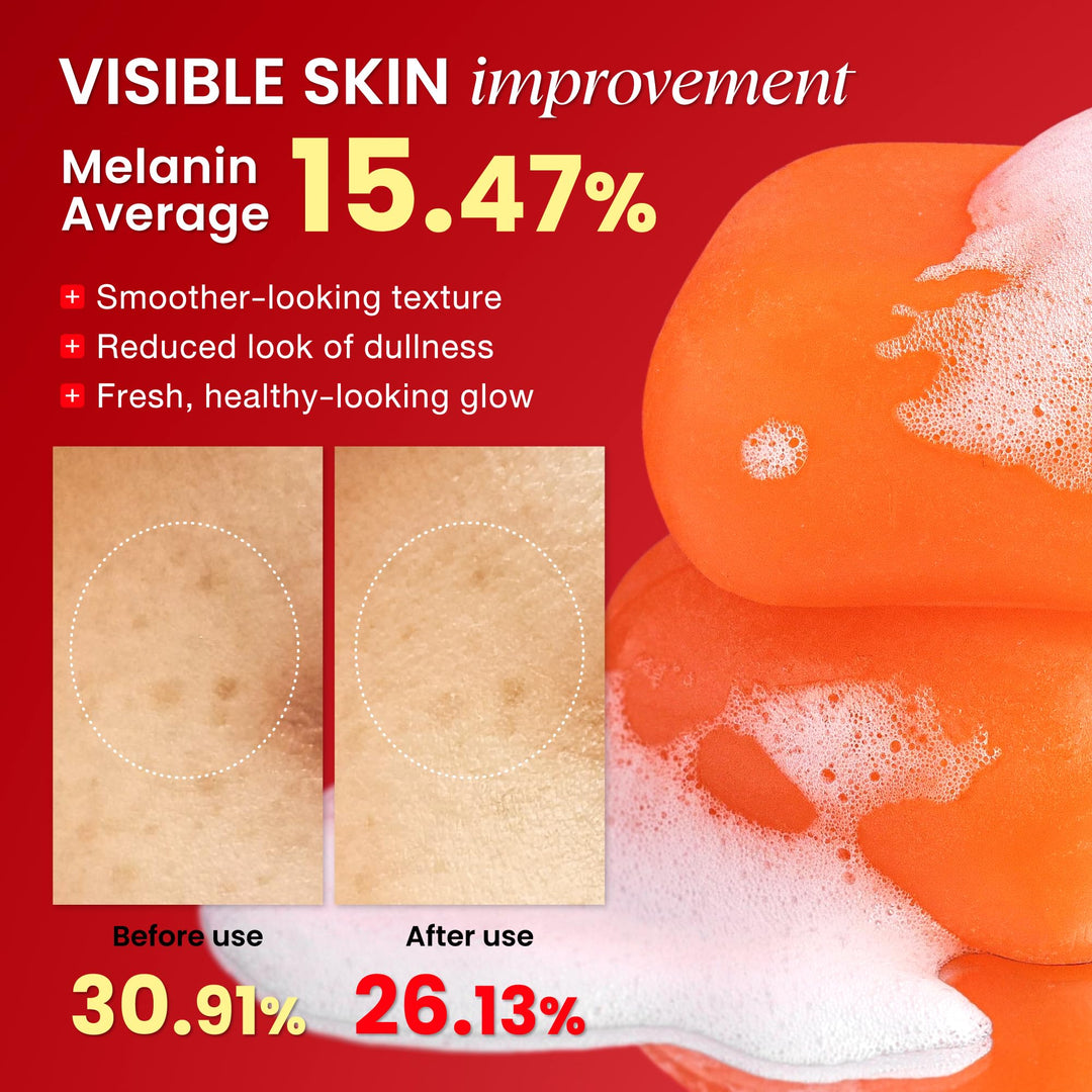 Koji White Pure Kojic Acid Soap, Tea Tree, Coconut Oil, Hyaluronic Acid, Vitamin C, 2.82 oz