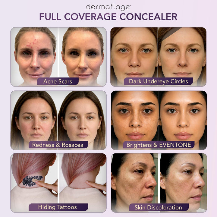 Dermaflage Full Coverage Concealer Cream, Bronze Dark, 6 g
