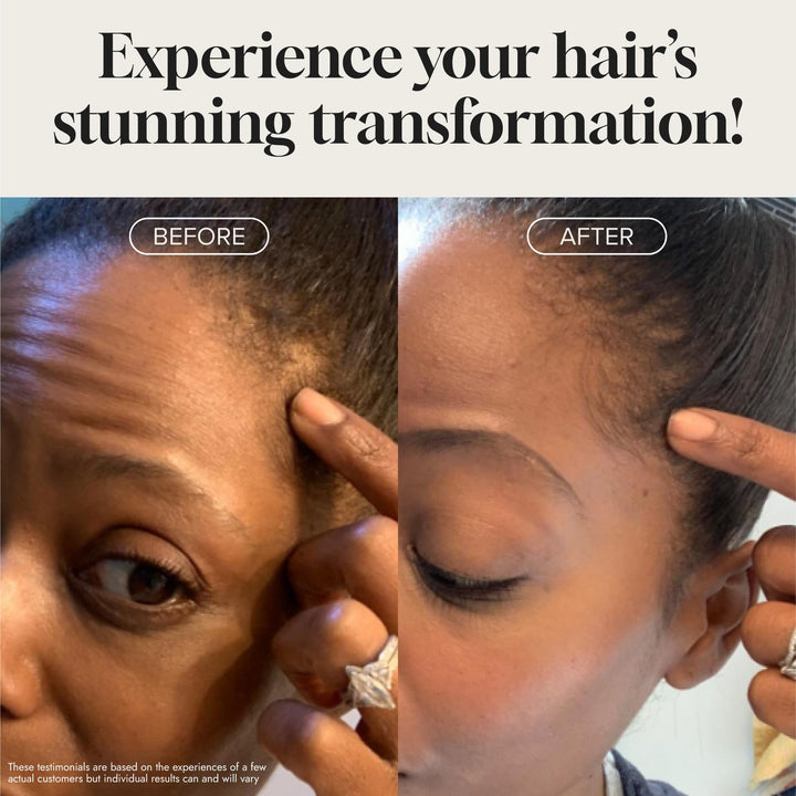 Meraz Pureauty Naturals Biotin Hair Growth Serum