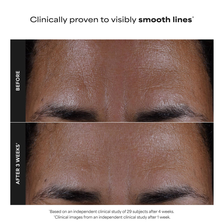 PAULA'S CHOICE Skin Perfecting 2% BHA Liquid Exfoliant, 30 ml