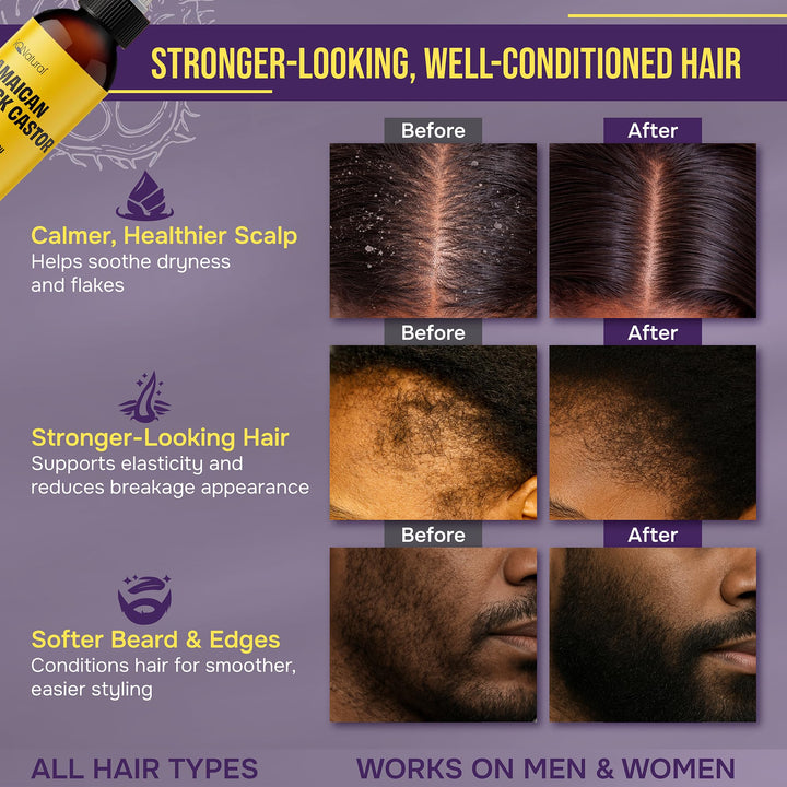 IQNATURAL Jamaican Black Castor Oil, Regular, 4 fl oz