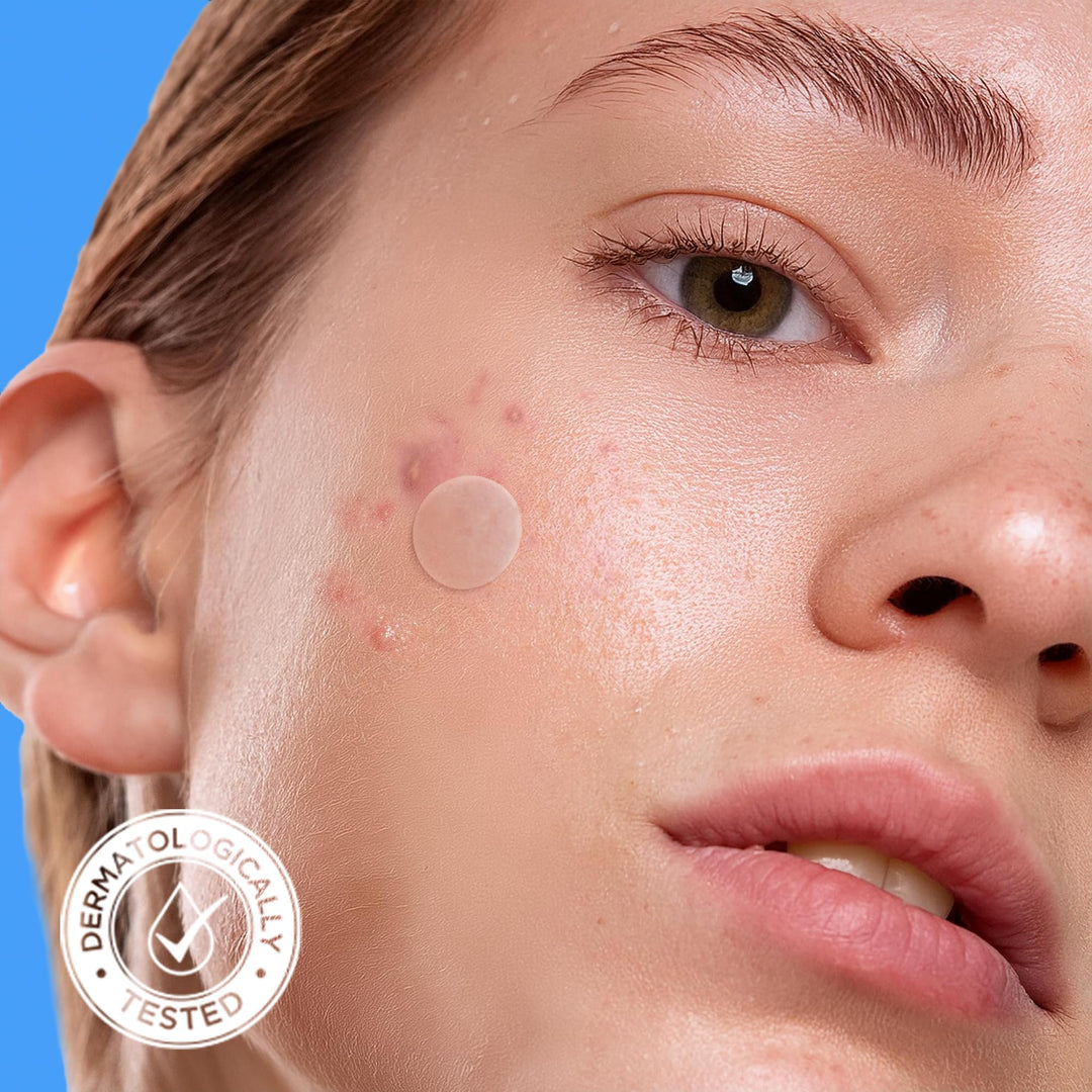 AVARELLE Hydrocolloid Acne Pimple Patches, 40 Count