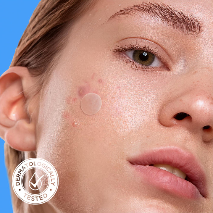 AVARELLE Hydrocolloid Acne Pimple Patches, 40 Count