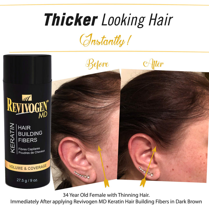 Revivogen MD Keratin Hair Building Fibers, Medium Brown, 0.9 oz