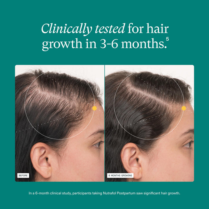 Nutrafol Postpartum Hair Growth Supplement, 120 Count