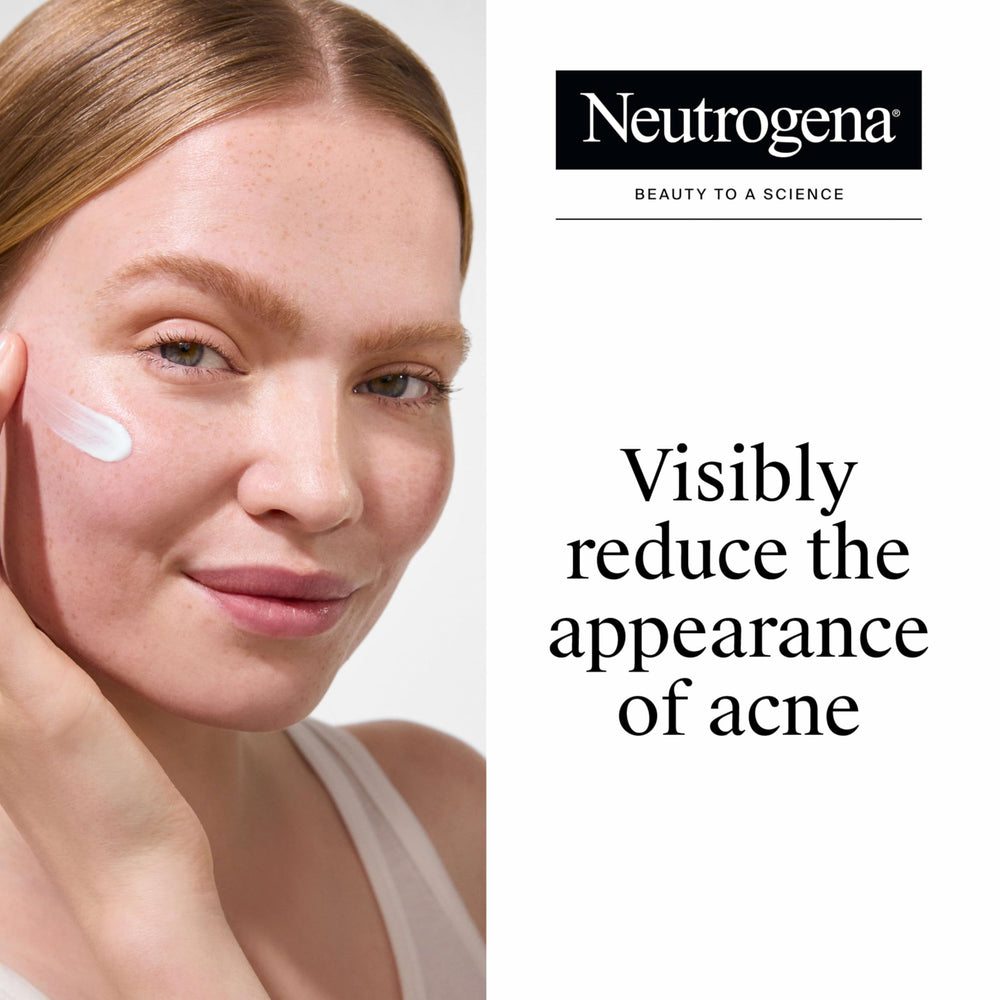 Neutrogena Rapid Clear Stubborn Acne Spot Treatment Gel, 10% Benzoyl Peroxide, 1 oz
