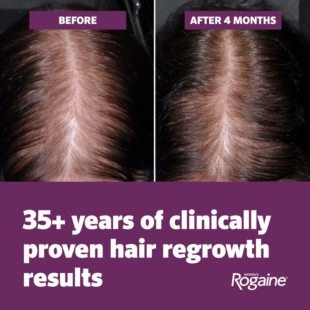 Rogaine Hair Regrowth Treatment Foam