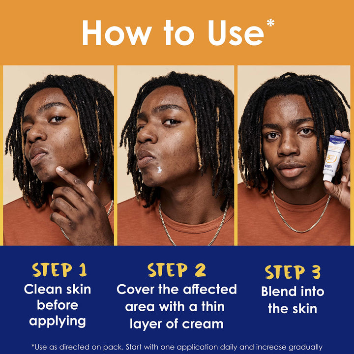 Clearasil Stubborn Acne Control 5in1 Spot Treatment Cream, Maximum Strength, 10% Benzoyl Peroxide, 1 oz